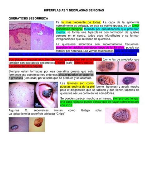 TUMORES BENIGNOS dermatologicos | Tumores | Benignos | uDocz
