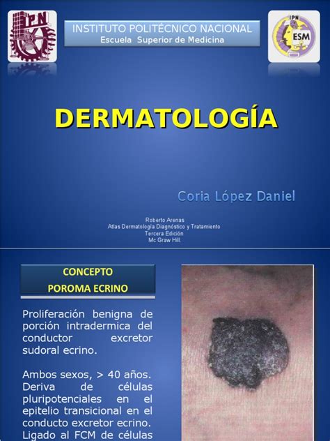 Tumores Benignos en Dermatología | Cáncer | Especialidades ...