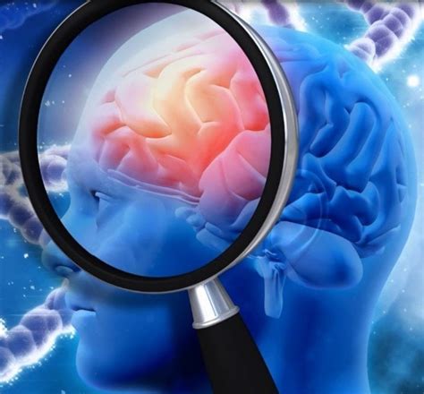 Tumores cerebrales más comunes en adultos y sus síntomas