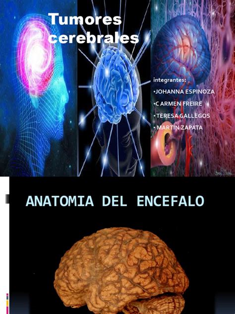 tumores cerebrales