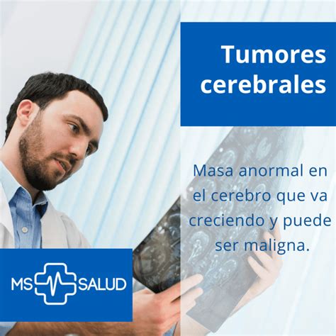 Tumores cerebrales | Síntomas y diagnóstico | MS Mas Salud