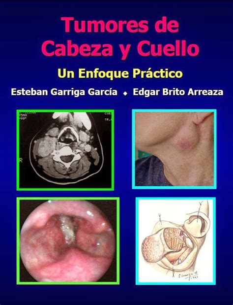 Tumores de Cabeza y Cuello. Un enfoque práctico | booksmedicos