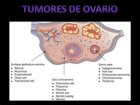Tumores de celulas germinales