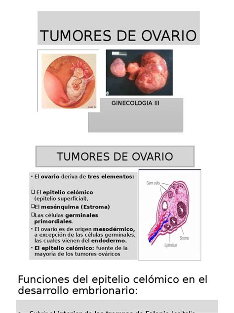 Tumores de Ovario | PDF | Cáncer de ovarios | Cáncer