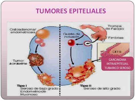 Tumores del ovario. Patologia clinica DE pORTH
