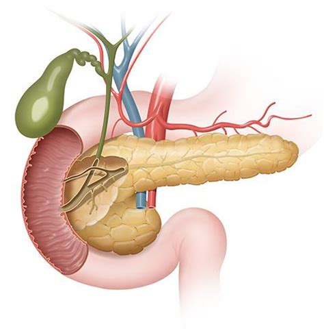 Tumores exocrinos de páncreas, qué son Salud al día