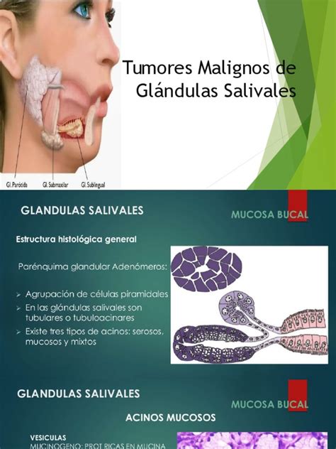 Tumores Malignos de Glandulas Salivales Mod | Cáncer | Medicina CLINICA