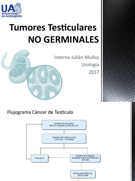 Tumores Testiculares No Germinales | Testículo | Cáncer