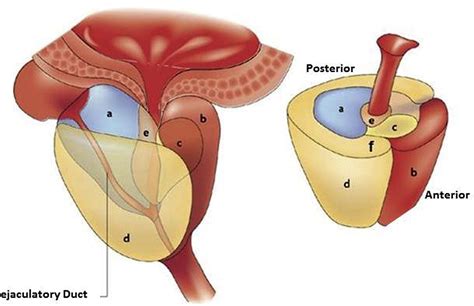 Tumors of the Anterior Prostate: Implications for Diagnosis and ...