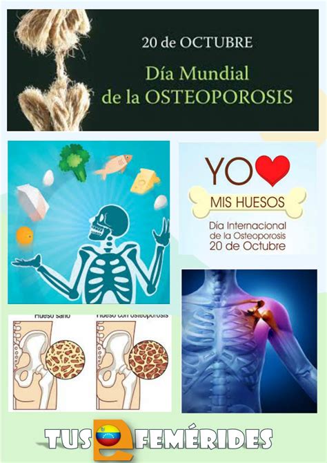Tus Efemérides Escolares: 20 de Octubre día Mundial Contra La Osteoporosis