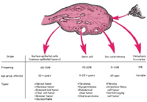 types of ovarian cancer types of ovarian cancer | Healt ...