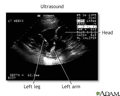 Ultrasound Information | Mount Sinai   New York