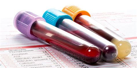 Un análisis de sangre sirve para detectar ocho tipos de ...