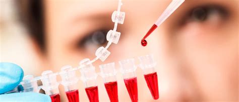 Un simple análisis de sangre detecta 8 tipos de cáncer ...