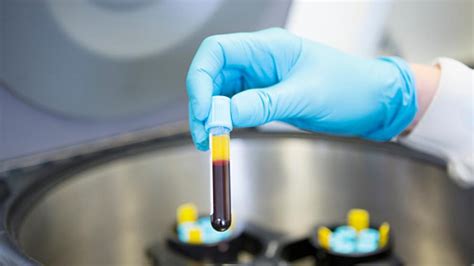 Un test de sangre abre la vía a la detección de ocho tipos ...