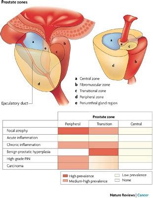 Urología Peruana: Dr. Susaníbar: Cáncer de próstata: anatomía