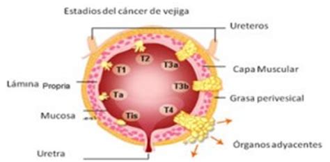 Urólogos en Salamanca   Clínica de urología Inursa