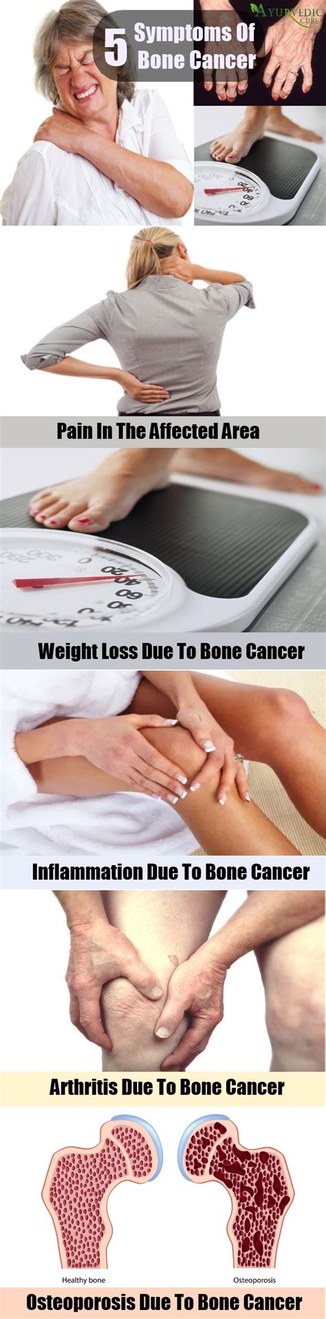 Various Bone Cancer Signs And Symptoms | Herbal Supplements