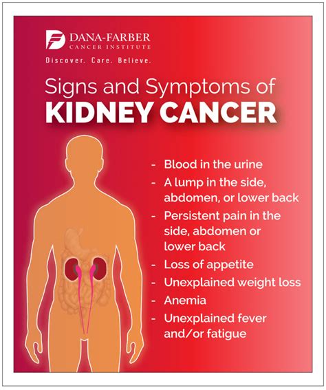 What Is Kidney Cancer? | Dana Farber Cancer Institute