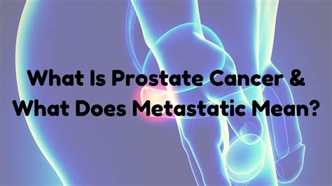 What Is Prostate Cancer? What Does Metastatic Mean?   YouTube