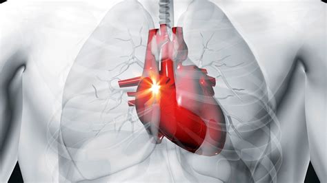 What is the treatment & life expectancy for Pulmonary ...