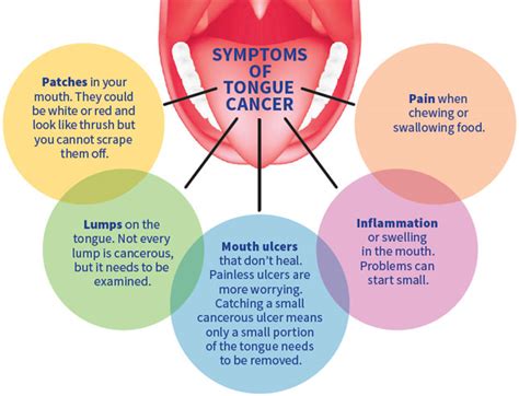 What Is Tongue Cancer? | MD Health.com