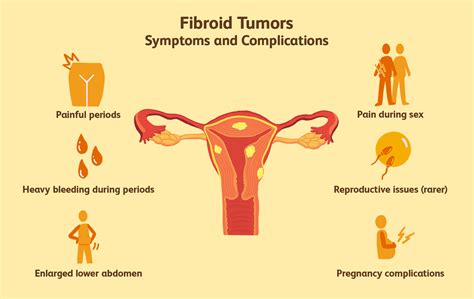 What is uterine fibroids? Causes, symptoms and types of ...