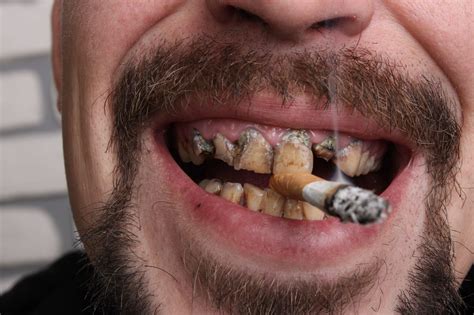 What Tobacco Does to Your Oral Health   West Palm Beach ...