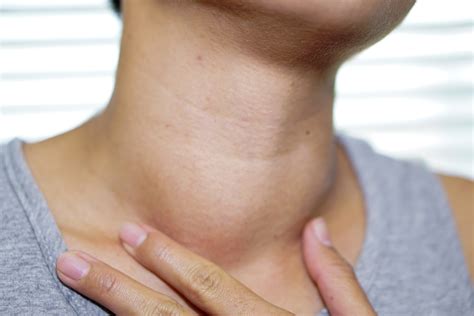 When should I be worried about a lump in my neck?