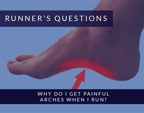 Why do I get painful arches when I run? | Alexandra Sports