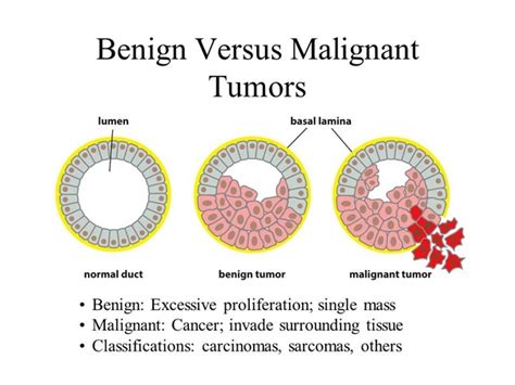 Why it is said that malignant tumors are cancerous?   Quora