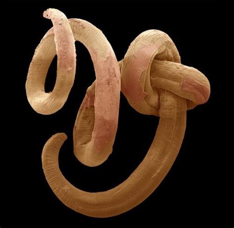 Würmer: nicht nur ein Kinder Parasit